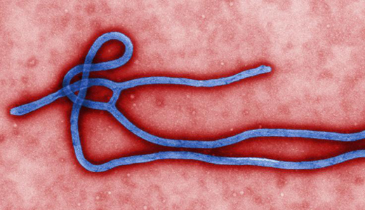 警惕最新病毒病人，你需要了解這些關(guān)鍵信息！