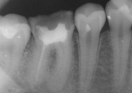 中國(guó)再生牙齒研究新進(jìn)展，重塑微笑，科技引領(lǐng)牙齒再生新篇章