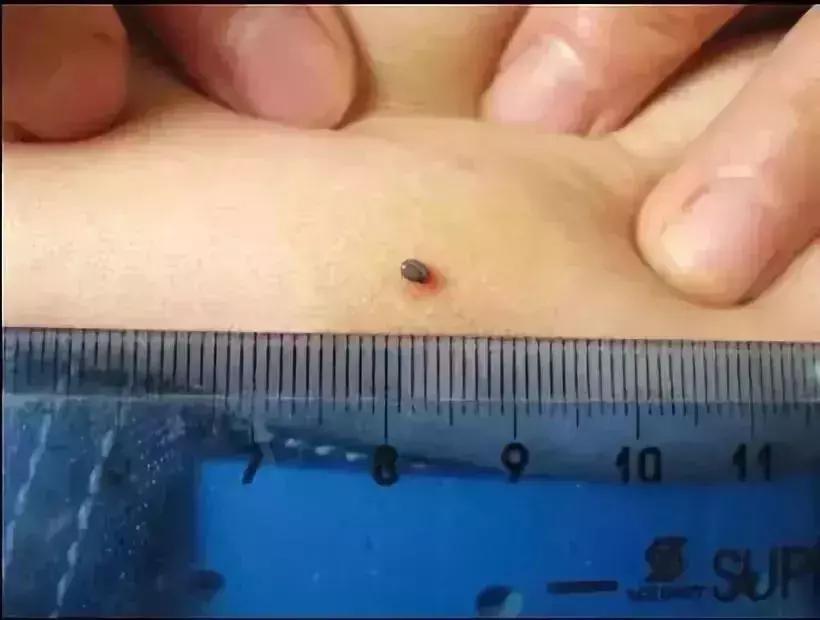 小明快樂疫情日志，最新疫情發(fā)布與日常觀察