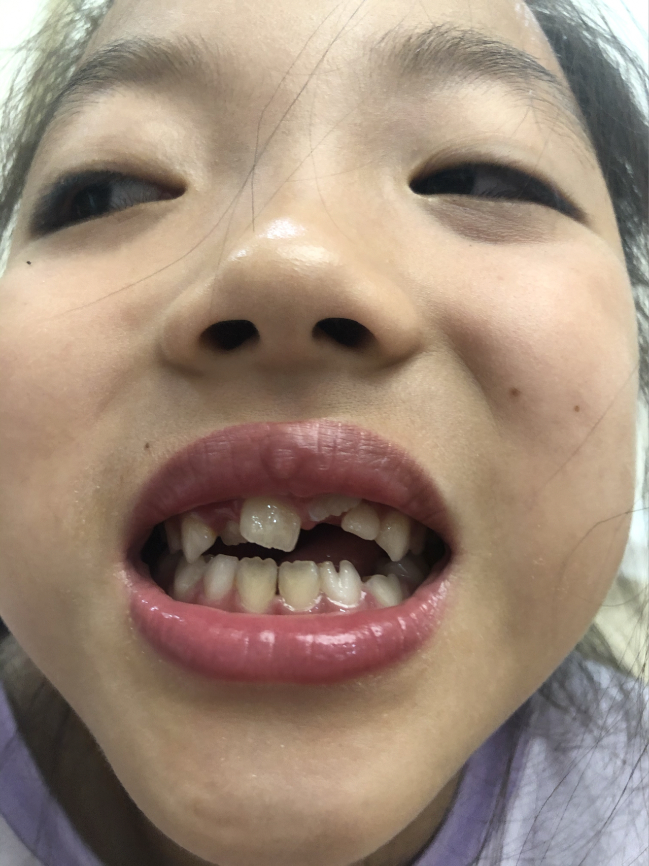 莊最新牙齒技術(shù)揭秘，牙齒美容新選擇