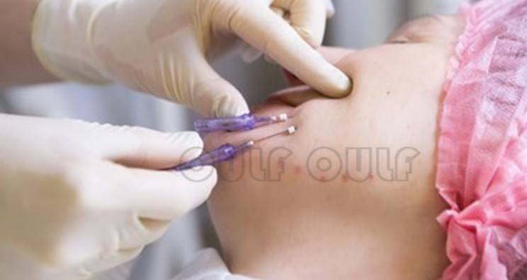 線雕最新手法，背景、發(fā)展、時代地位及展望